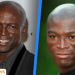 What happened to Seal’s face