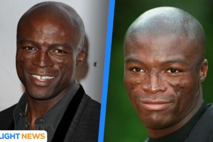 What happened to Seal’s face