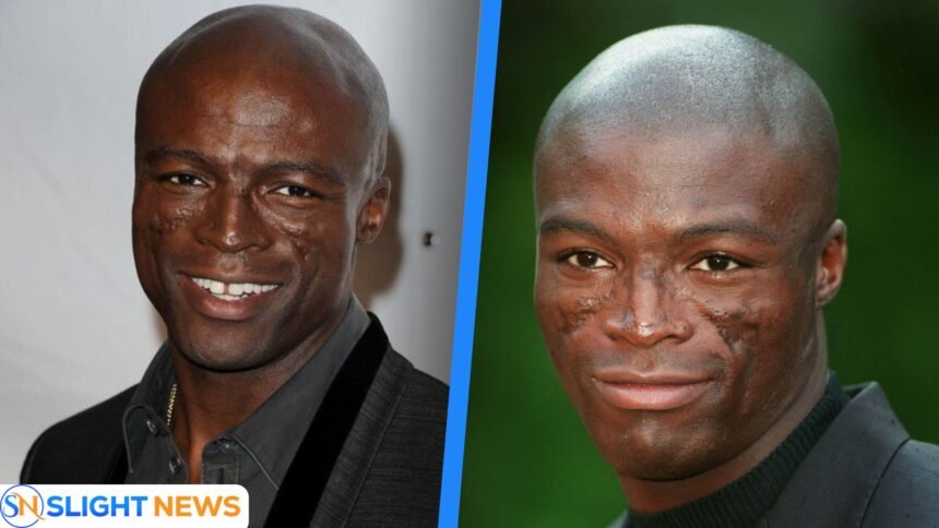 What happened to Seal’s face
